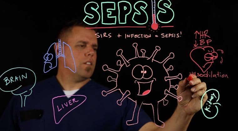 4701 Sepsis (ALS)