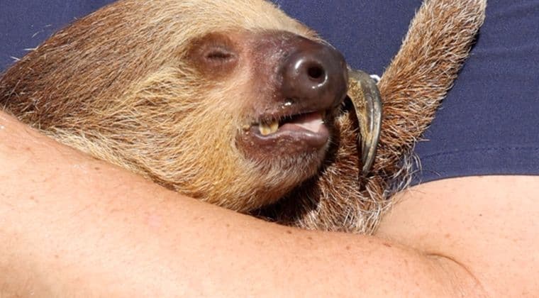 4004 Rhythm Recognition: Bradycardias (ALS)